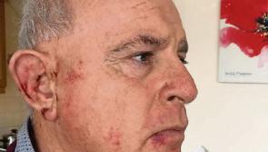 Witness appeal after bizarre 'bloodbath brawl' in Limerick city