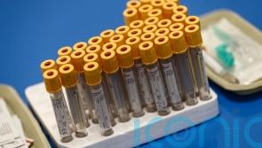 Omicron variant drives daily US death toll higher than during Delta wave