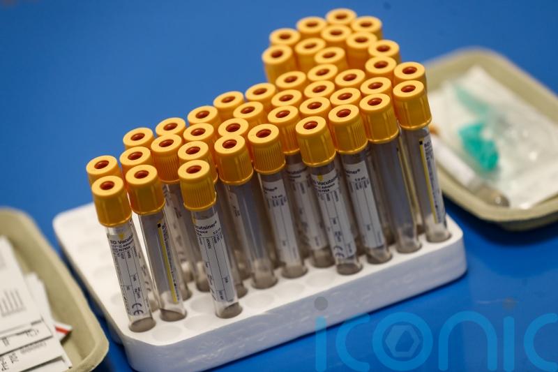 Omicron variant drives daily US death toll higher than during Delta wave